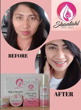 Load image into Gallery viewer, Shantahl Rejuvenating Set (Kojic Acid Soap, Night Cream, Sunblock Cream & Toner)