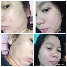 Load image into Gallery viewer, Shantahl Rejuvenating Set (Kojic Acid Soap, Night Cream, Sunblock Cream & Toner)