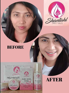 Shantahl Rejuvenating Set (Kojic Acid Soap, Night Cream, Sunblock Cream & Toner)
